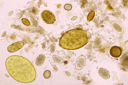 Worm Analysis